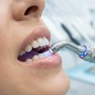 Tratamiento dental integral